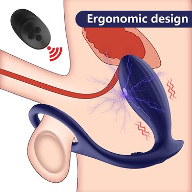 Анальні вібратори PQKuss для пар: стимулятор простати з 3 режимами шоку та 10 вібрацій, електричний анальний плагін та кільце для пеніса, силікон