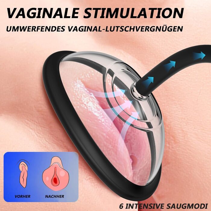 Електрична вакуумна пампушка для жінок з 6 рівнями потужності, для кліторальної та вагінальної стимуляції, 5 присосок (2 великі + 3 малі) - секс-іграшки для жінок та пар