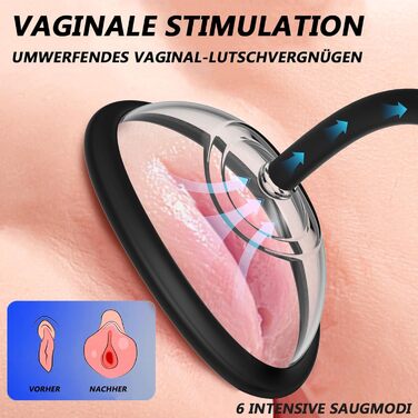 Електрична вакуумна пампушка для жінок з 6 рівнями потужності, для кліторальної та вагінальної стимуляції, 5 присосок (2 великі + 3 малі) - секс-іграшки для жінок та пар